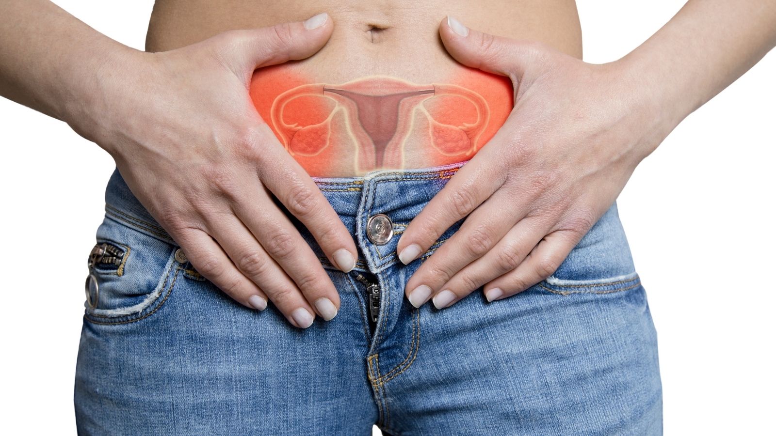 Çikolata Kisti (Endometrioma) Tedavisi